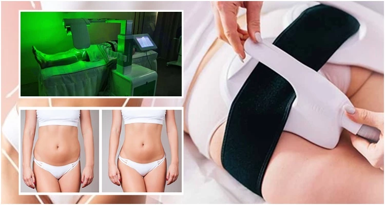 NAJNOVIJI 10D LASER 3 U 1 - LASER, KRIOLIPOLIZA, BODY FORMER U KOMBINACIJI S TESLOM do čak 3 konfekcijska broja manje u samo 6 dolazaka!