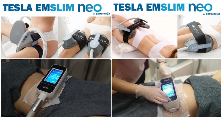 TESLA EMSLIM NEO/RF I CRYOCOOLSCULPTING 360! Trajno uklonite višak kilograma, neželjeni celulit i zategnite kožu!