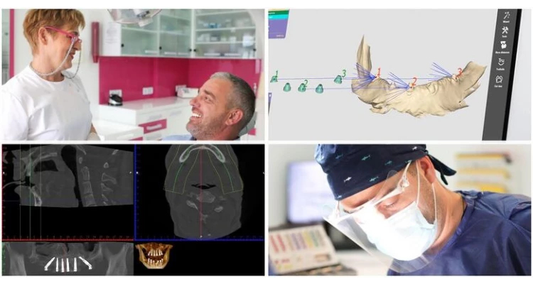 CBCT 3D snimka kompletne gornje i donje čeljusti uz detaljnu analizu snimke, besplatan dentalni pregled i konzultacije - uklonite sumnje na određene bolesti usne šupljine