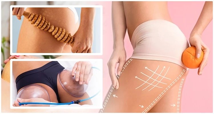 Riješite se masnih naslaga tamo gdje Vam najviše smetaju uz 10 tretmana brazilske maderoterapije i 10 but lift tretmana za podizanje stražnjice!