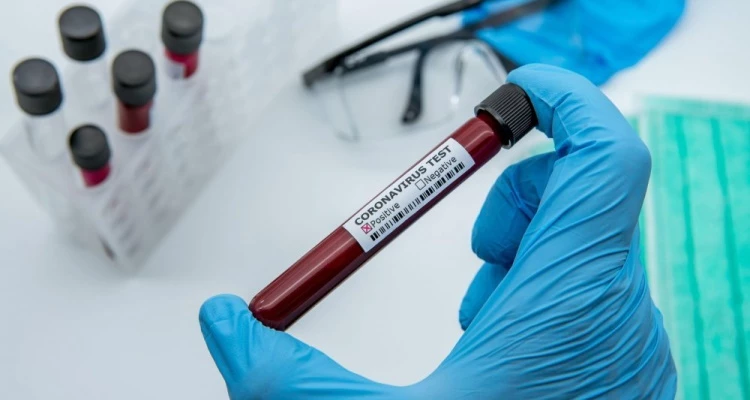 Serološko testiranje na COVID-19 u Poliklinici Latebra!