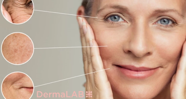 Teosyal dermalni filer 1ml i botox Vistabel 50 jedinica - vratite mladoliki izgled i riješite se bora te podignite obrve ili povećajte usne!